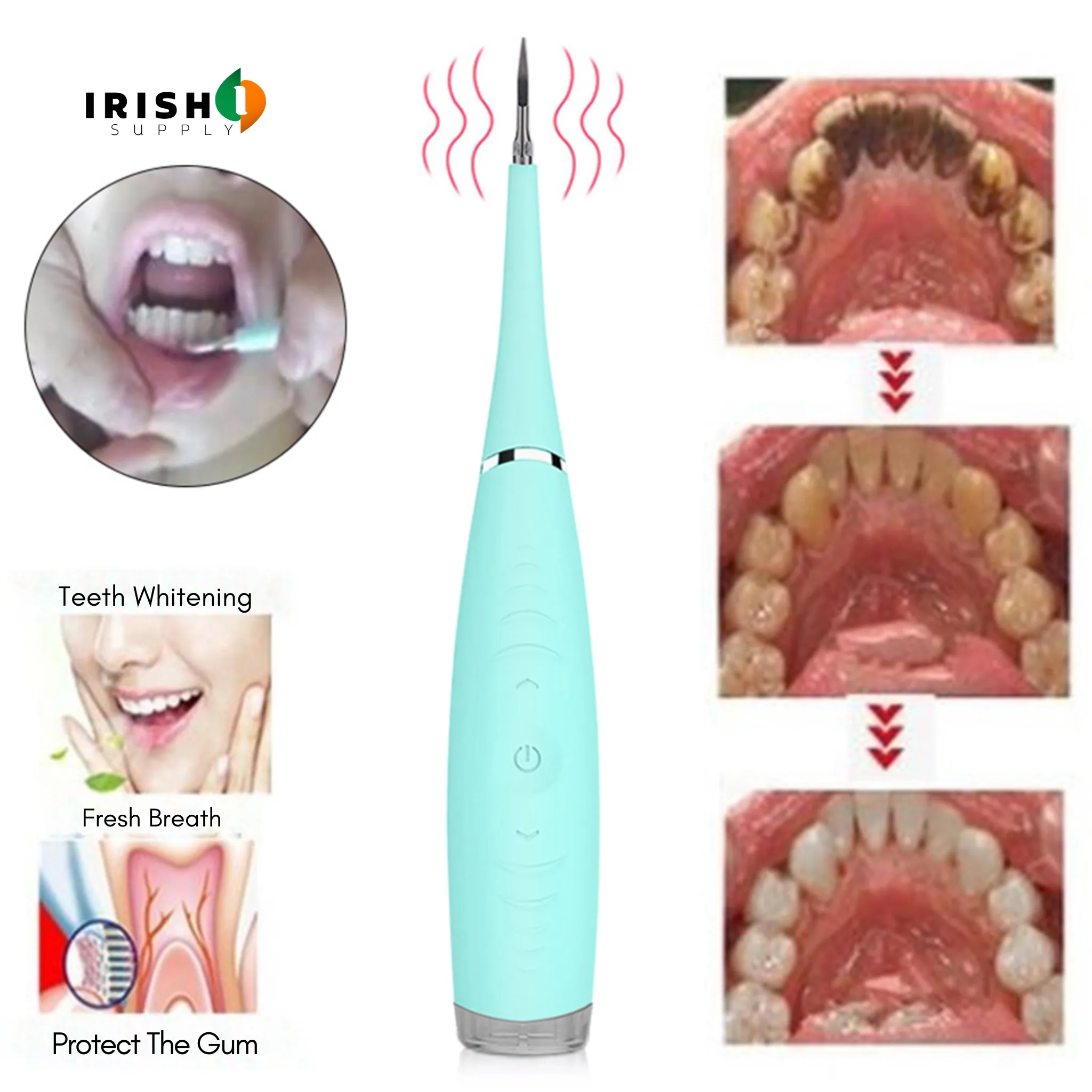 BRUSHTEK Advanced Ultrasonic Dental Cleaner